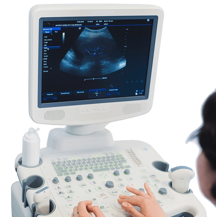 врач проводящий УЗИ смотрит на экран монитора